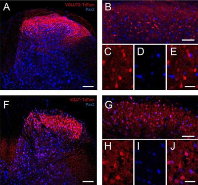 Transgenic Cross-Referencing of Inhibitory and Excitatory Interneuron Populations to Dissect Neuronal Heterogeneity in the Dorsal Horn